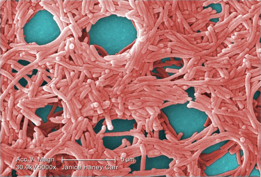 Legionella under mikroskop, färgsatt